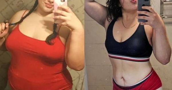 Resultado real clienta Tower Shop — Slim Patch